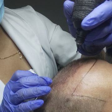 Micropigmentação e estética - Maia - Investigação Privada