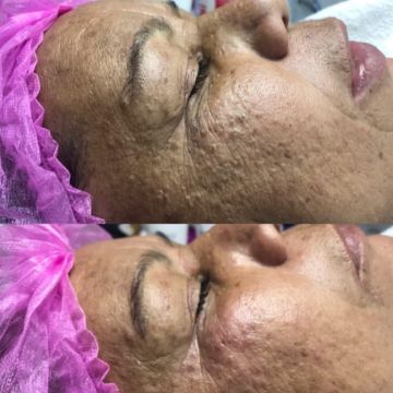 Micropigmentação e estética - Maia - Beleza