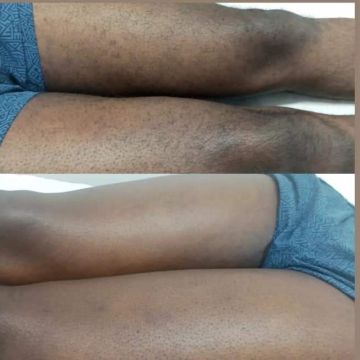 Massoterapia e Estética - Maia - Lymphatic Drainage