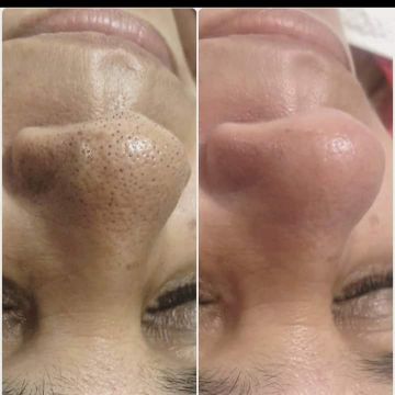 Massoterapia e Estética - Maia - Skin Cleansing