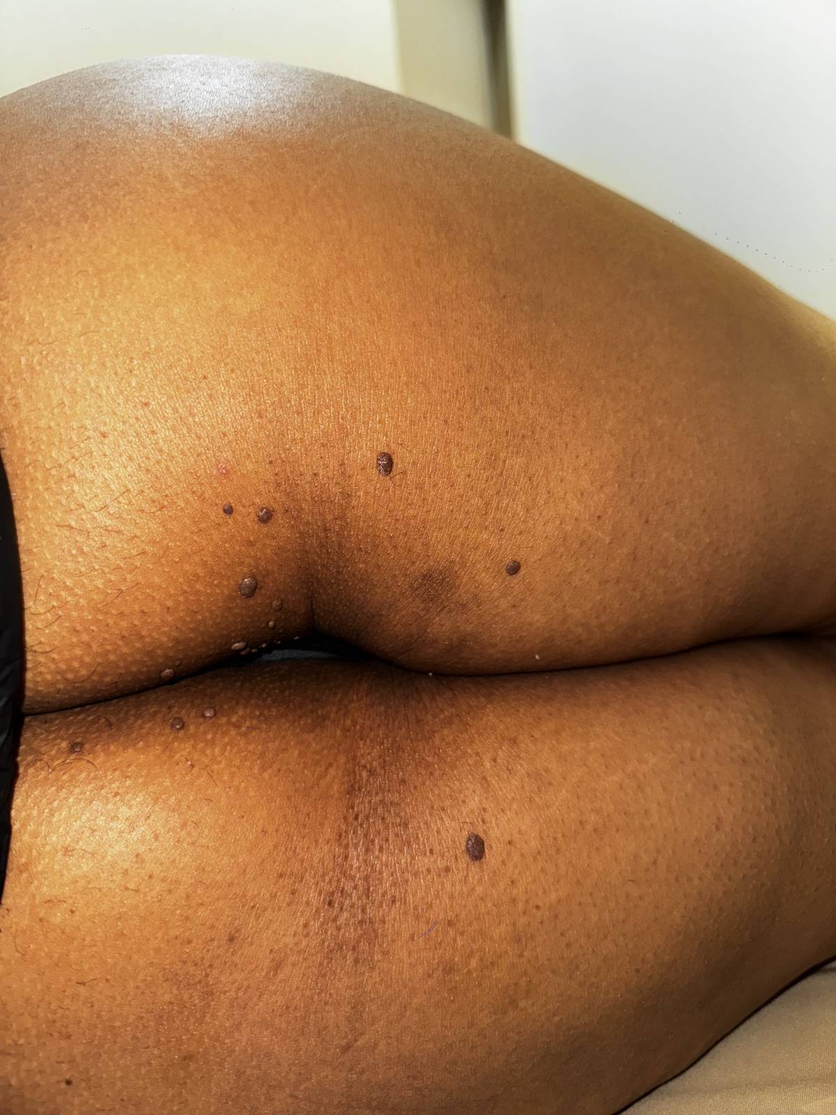 Débora Vicêncio - Almada - Hair Removal for Men