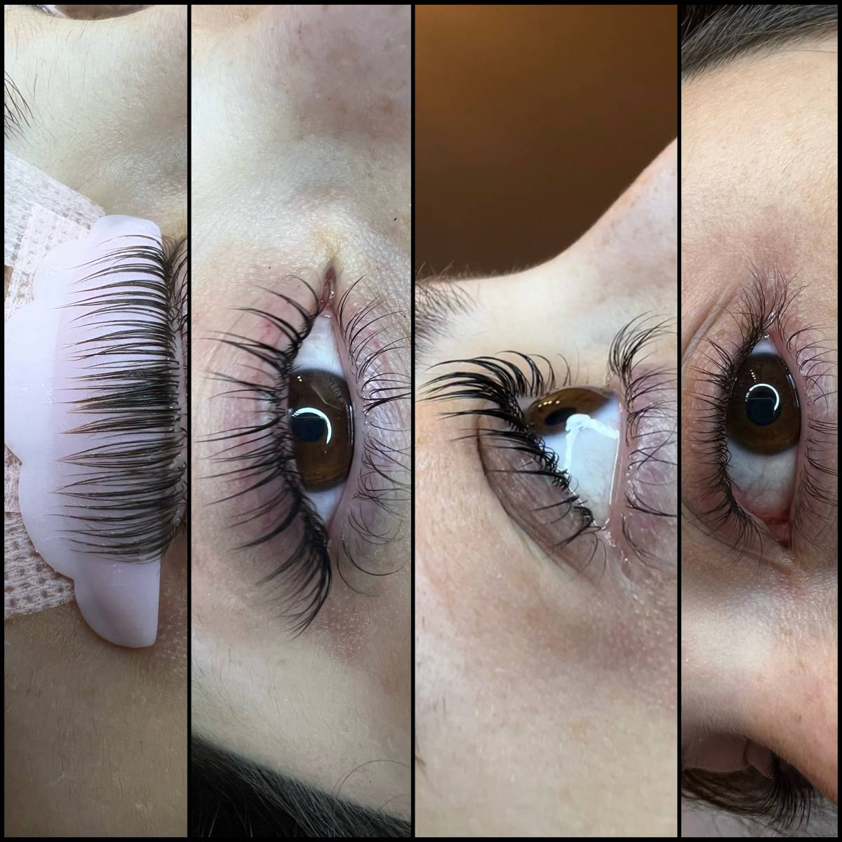 Débora Vicêncio - Almada - Laser Depilation