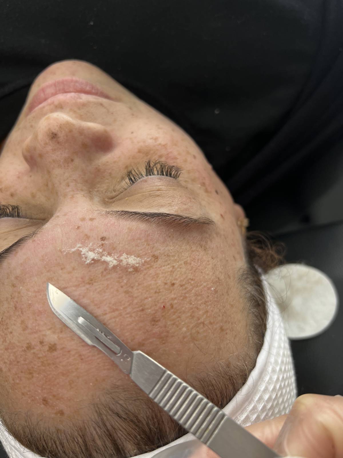 Débora Vicêncio - Almada - Depilation Centers