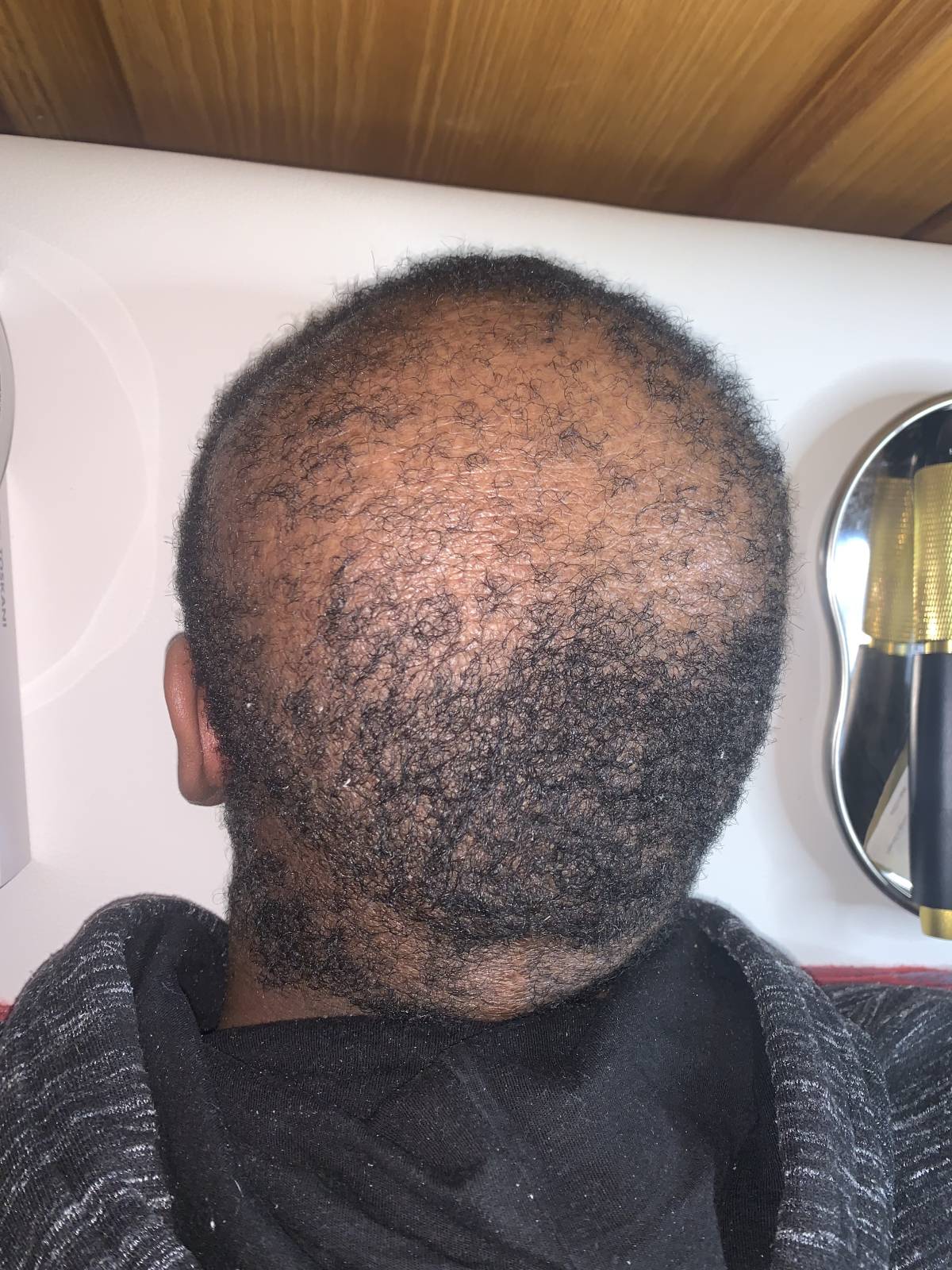 Débora Vicêncio - Almada - Hair Removal for Men
