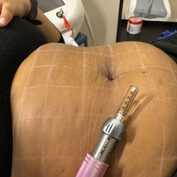 Débora Vicêncio - Almada - Skin Cleansing