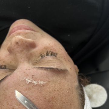 Débora Vicêncio - Almada - Depilation Centers