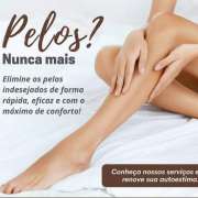 Maria Joao - Lousada - Therapeutic Massage