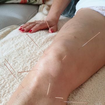João Fonseca Medicina Tradicional Chinesa - Lisboa - Massagem Desportiva
