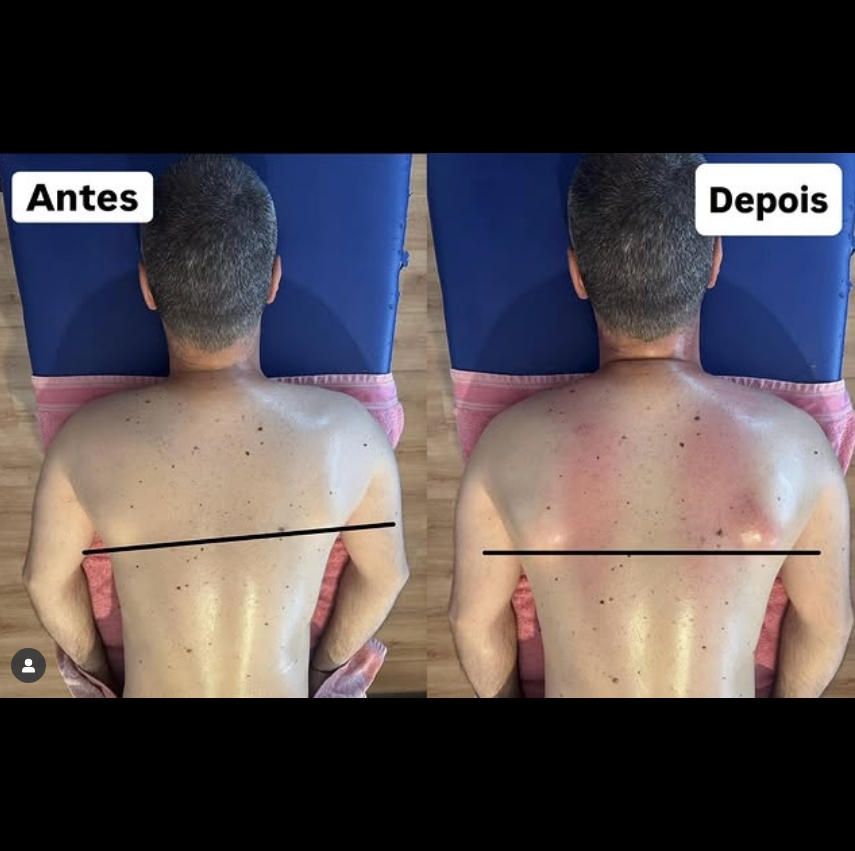 Carlos Martins - Massoterapeuta - Viana do Castelo - Sports Massage