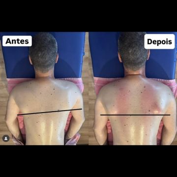 Carlos Martins - Massoterapeuta - Viana do Castelo - Sports Massage