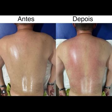 Carlos Martins - Massoterapeuta - Viana do Castelo - Therapeutic Massage