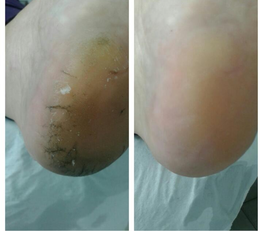 Patty Pimenta - Grândola - Manicura y pedicura (para mujeres)