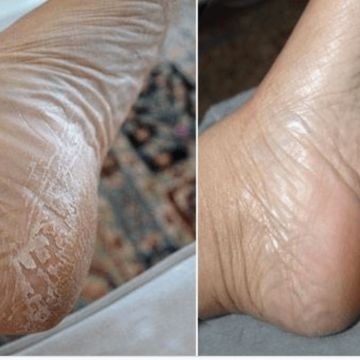 Patty Pimenta - Grândola - Manicura y pedicura