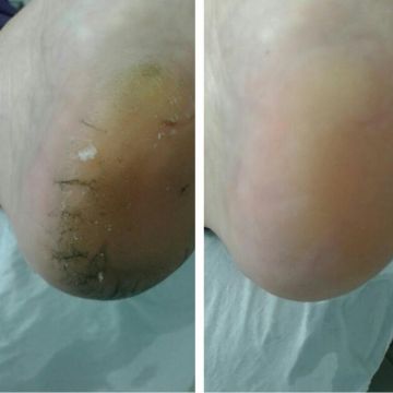Patty Pimenta - Grândola - Manicura y pedicura (para mujeres)