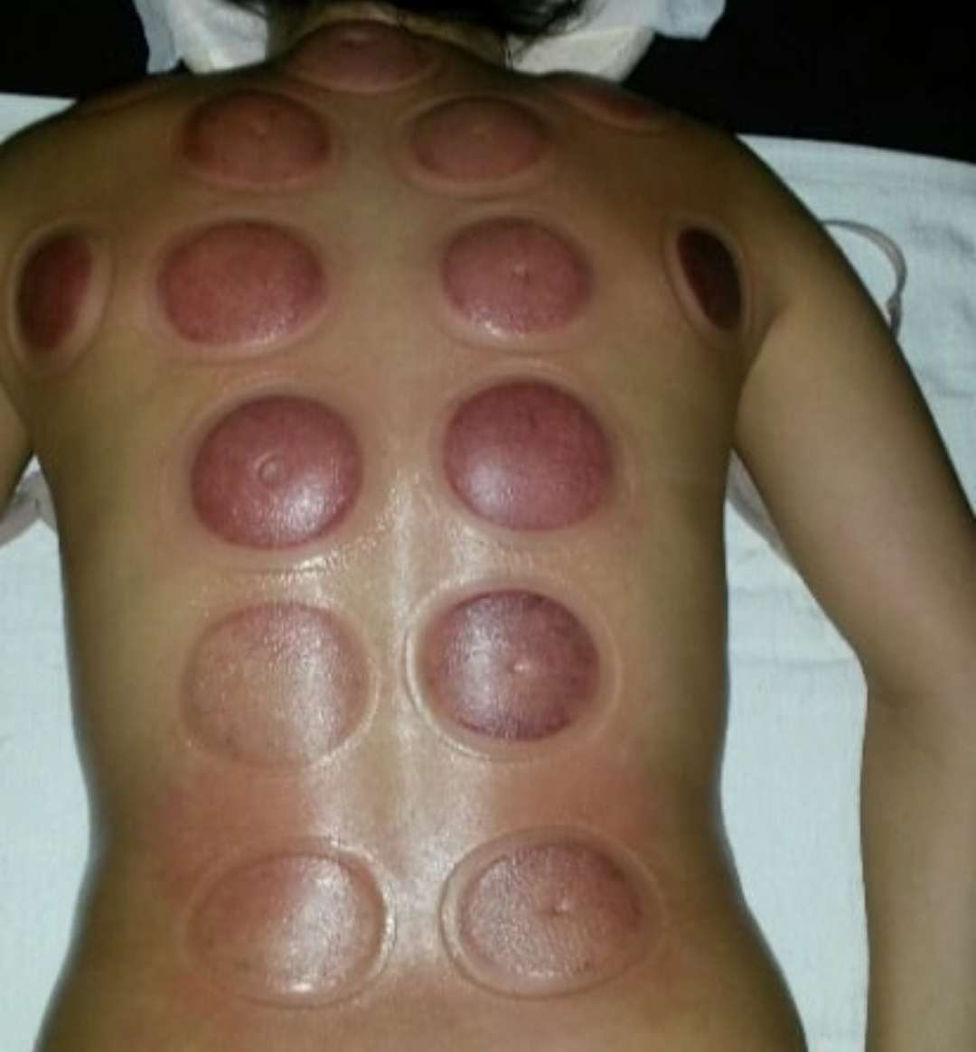 Massagem: - Albufeira - Masaje deportivo