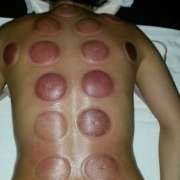 Massagem: - Albufeira - Masaje deportivo