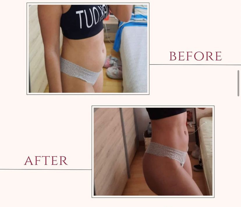 Bia Barros - Almada - Physiotherapy Sessions