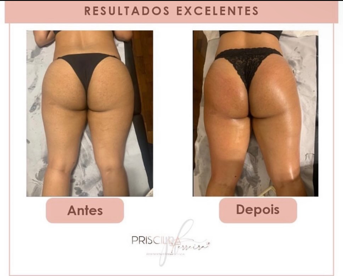 Priscilla Ferreira Estética - Lisboa - Pregnancy Massage