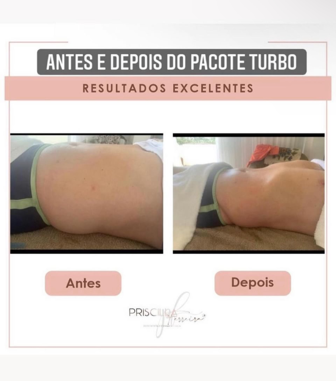 Priscilla Ferreira Estética - Lisboa - Massagem Terapêutica