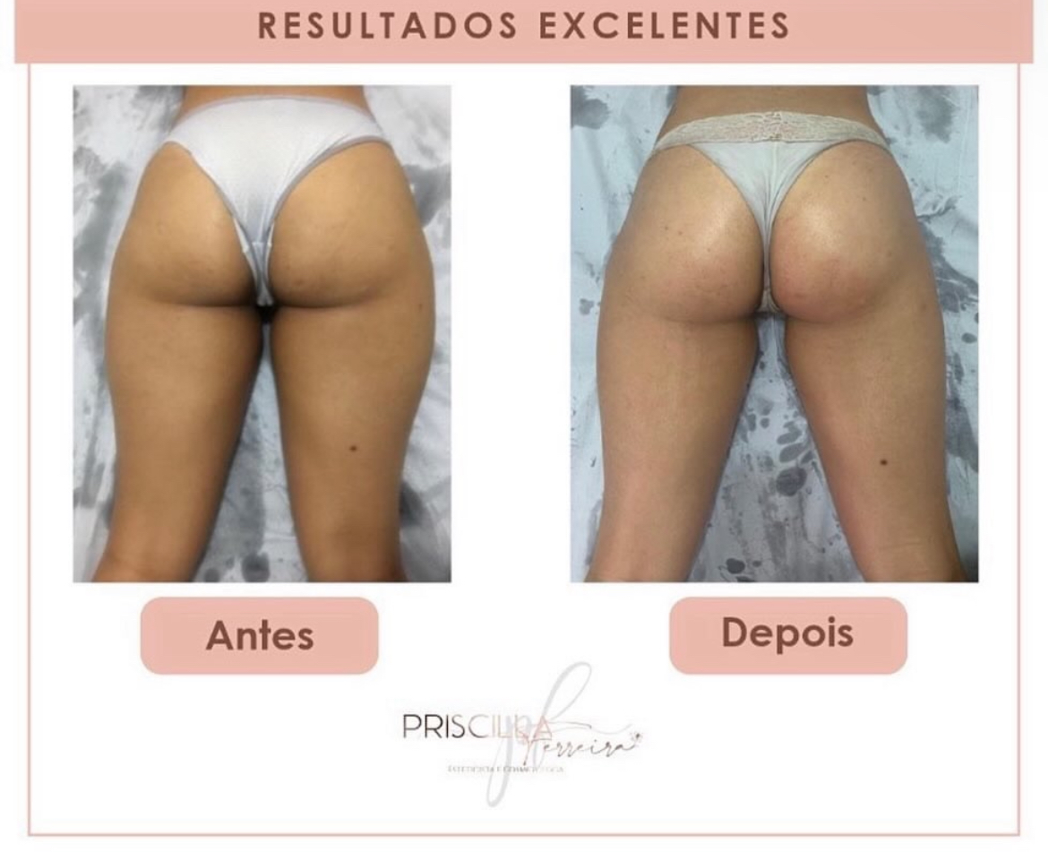 Priscilla Ferreira Estética - Lisboa - Sports Massage
