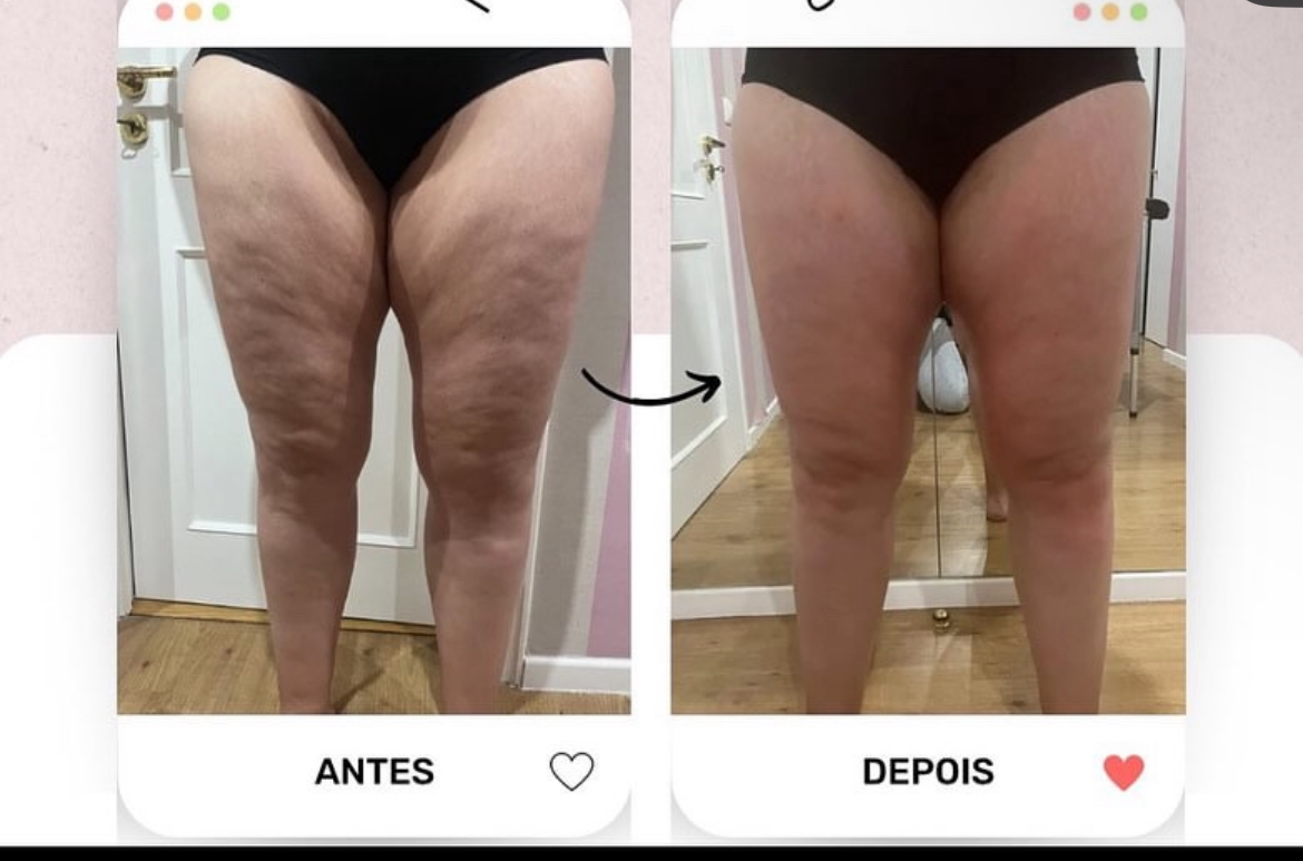 Priscilla Ferreira Estética - Lisboa - Facial