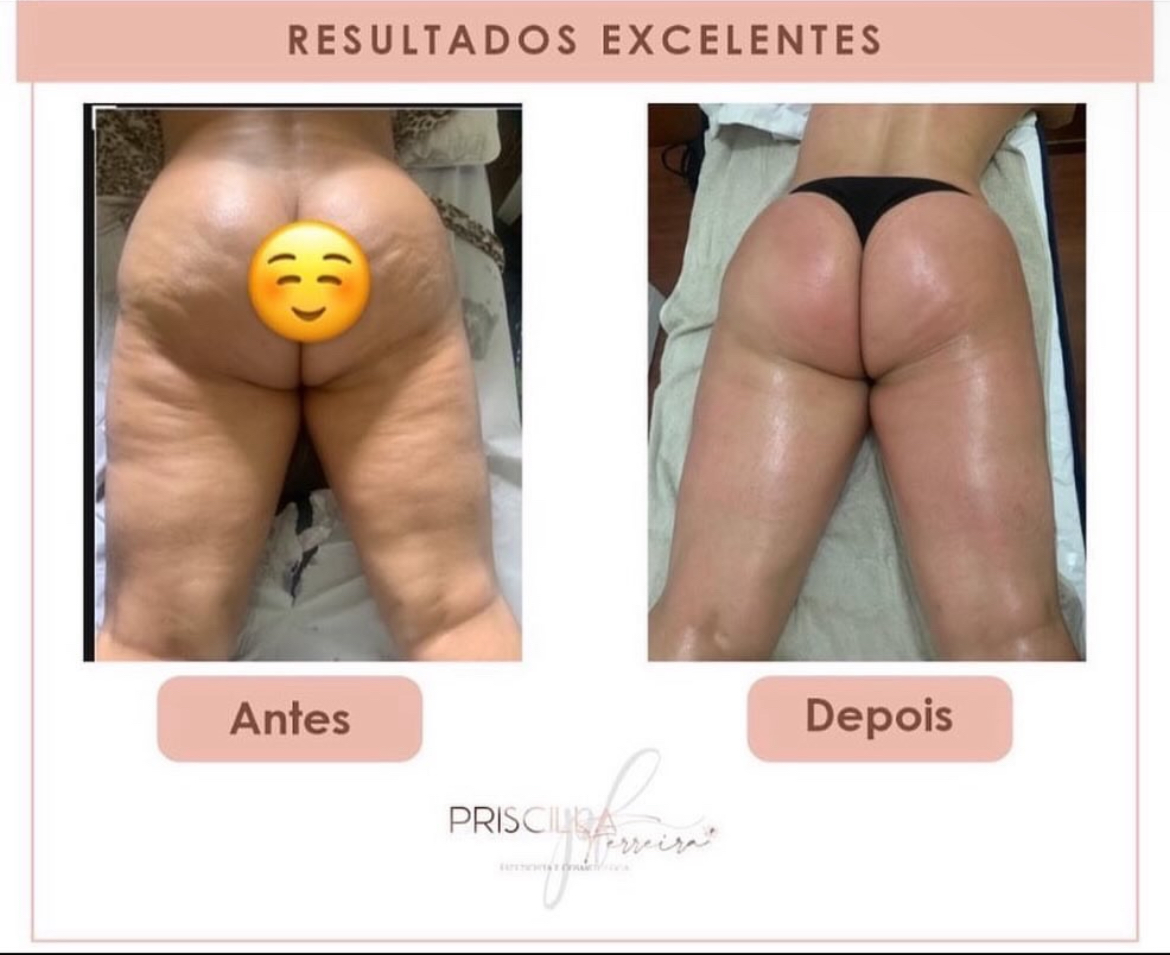 Priscilla Ferreira Estética - Lisboa - Couples Massage