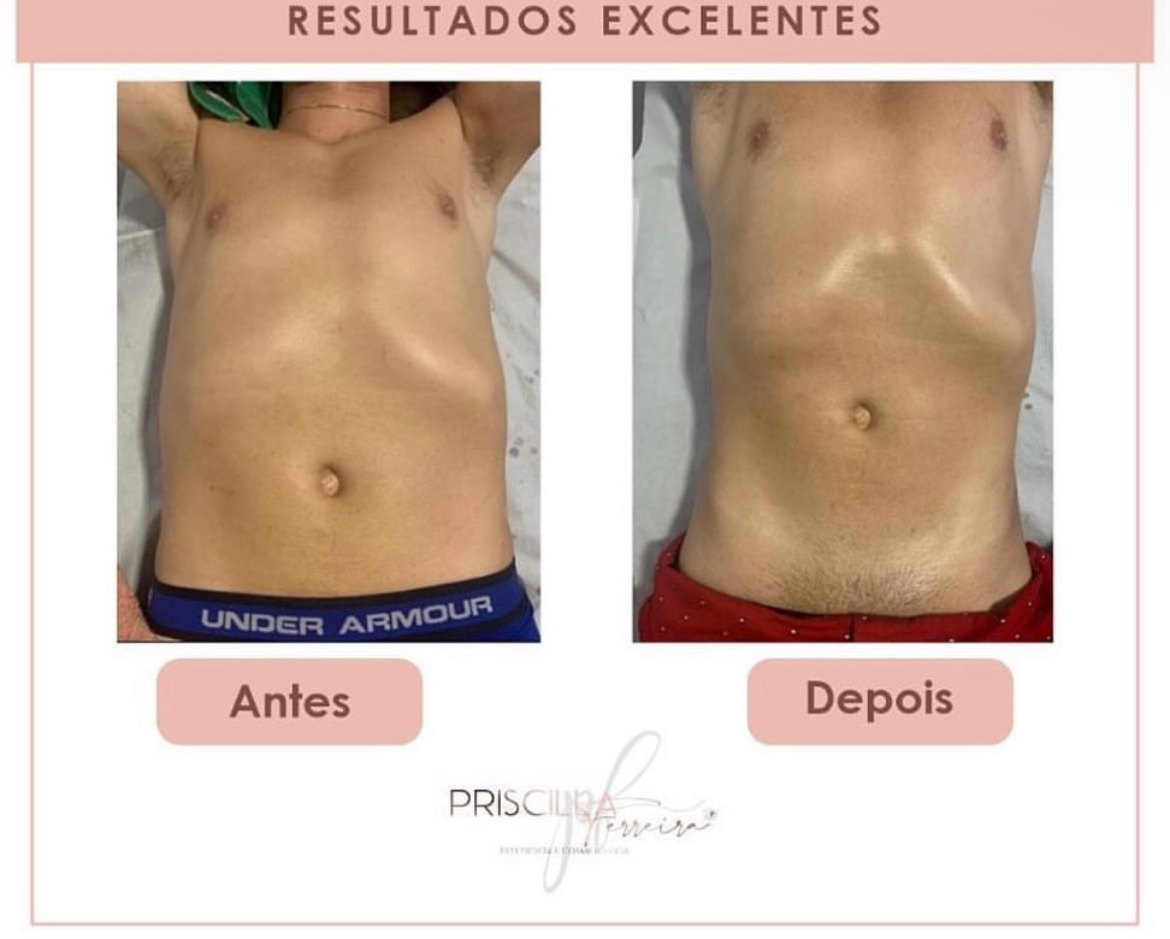 Priscilla Ferreira Estética - Lisboa - Hot Stone Massage