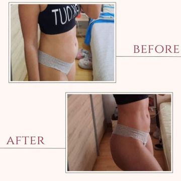 Bia Barros - Almada - Physiotherapy Sessions