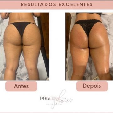 Priscilla Ferreira Estética - Lisboa - Pregnancy Massage
