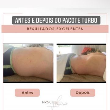 Priscilla Ferreira Estética - Lisboa - Therapeutic Massage