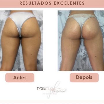 Priscilla Ferreira Estética - Lisboa - Sports Massage