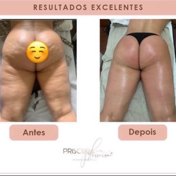 Priscilla Ferreira Estética - Lisboa - Couples Massage
