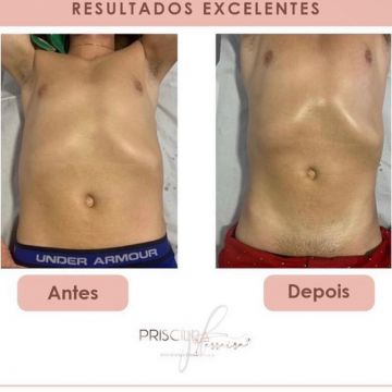 Priscilla Ferreira Estética - Lisboa - Hot Stone Massage