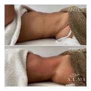 A.L.ma (Ana Lopes massagens) - Palmela - Massagem Terapêutica