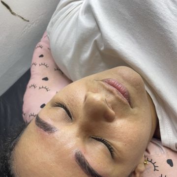 Natália Souza - Almada - Limpieza de la piel