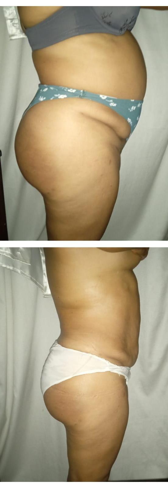 Velax Centro de Saude Estetica e Beleza Natural - Lisboa - Massagem Desportiva