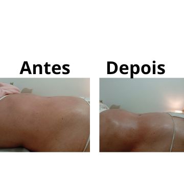 Velax Centro de Saude Estetica e Beleza Natural - Lisboa - Massagem Profunda