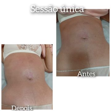 Velax Centro de Saude Estetica e Beleza Natural - Lisboa - Massagens