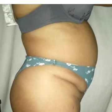 Velax Centro de Saude Estetica e Beleza Natural - Lisboa - Massagem Desportiva