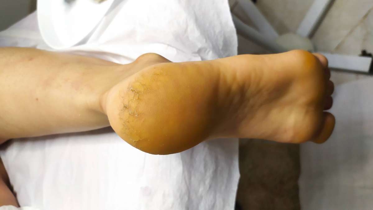 Katiane Novais de Melo Tavares - Ílhavo - Facial