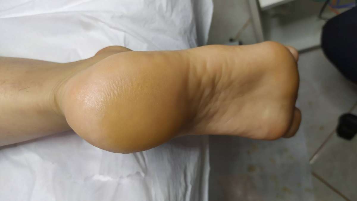 Katiane Novais de Melo Tavares - Ílhavo - Acupuncture Services