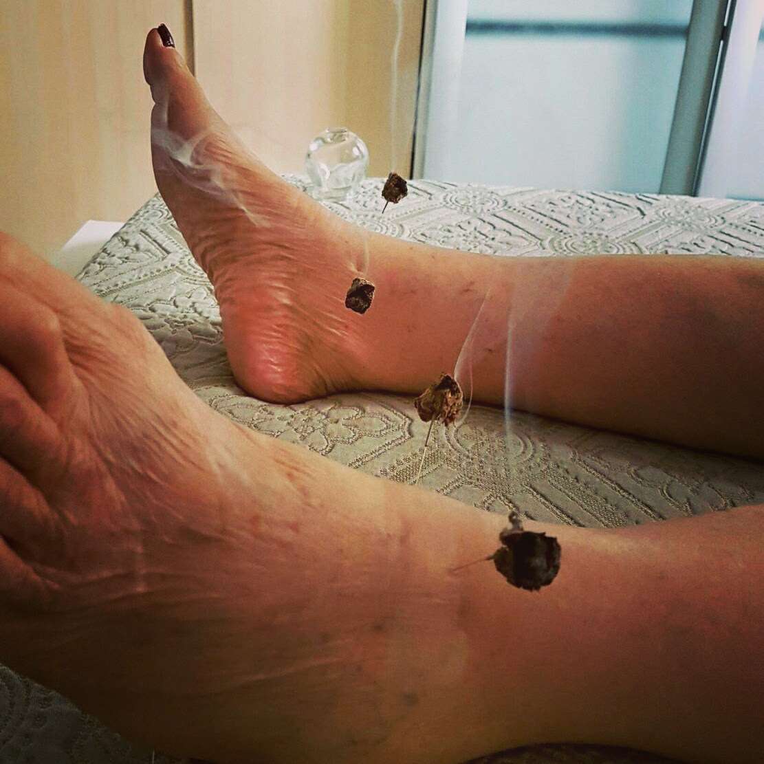 Rodrigo Lang - Braga - Acupuncture Services