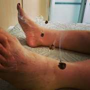 Rodrigo Lang - Braga - Acupuncture Services