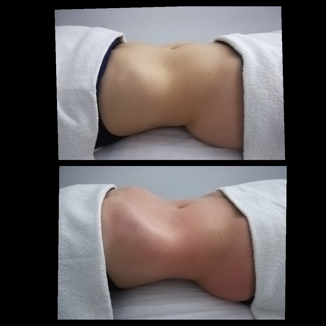Rozelia ferreira - Figueira da Foz - Deep Tissue Massage