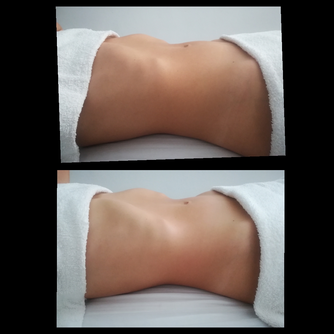 Rozelia ferreira - Figueira da Foz - Sports Massage