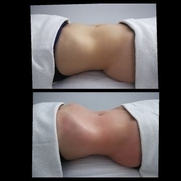 Rozelia ferreira - Figueira da Foz - Deep Tissue Massage