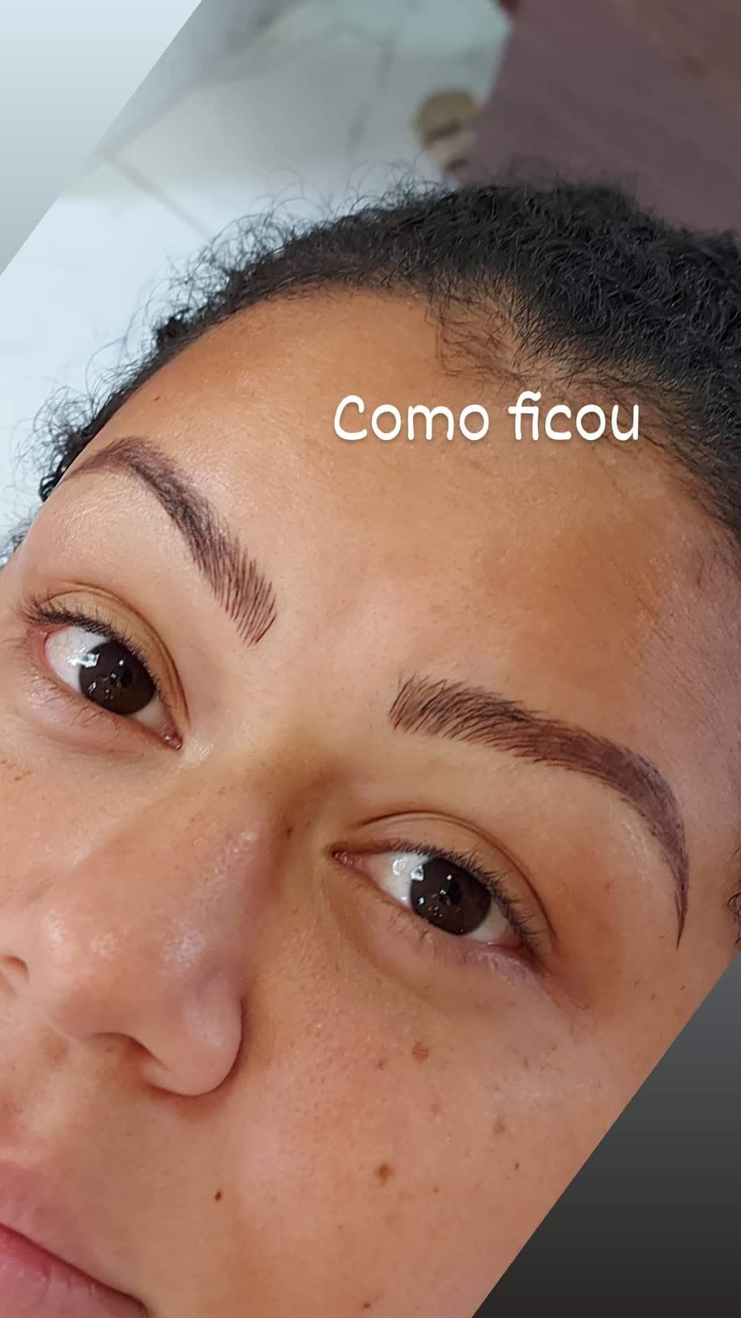 Claudia santana - Almada - Haarentfernung