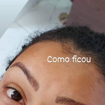 Claudia santana - Almada - Haarentfernung