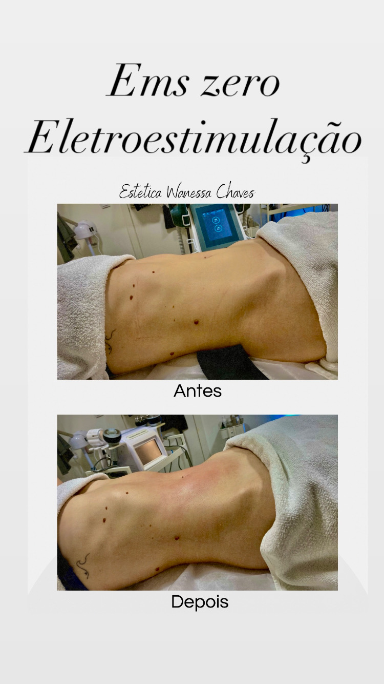 Vanessa chaves - Cascais - Lymphatic Drainage