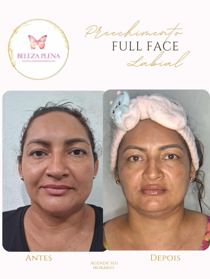 Danielle Oliveira - Setúbal - Skin Cleansing